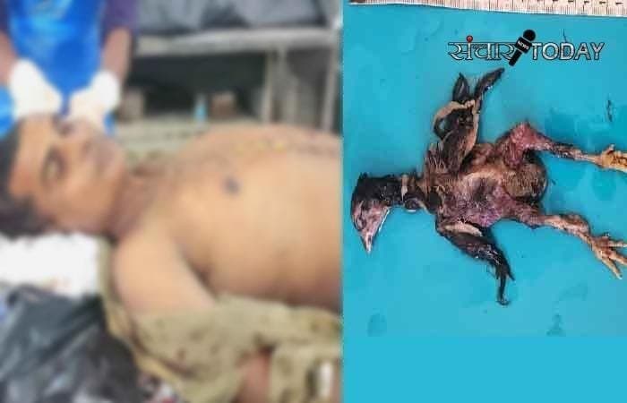 ब्रेकिंग अम्बिकापुर : जिंदा मुर्गा  निगलने से हुई युवक की मौत..... क्या था कारण पढ़े पूरी खबर |